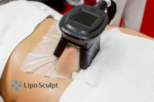 Are The Results From Aqualyx Permanent? 4 Compare Aqualyx Bootle to other fat reduction treatments.