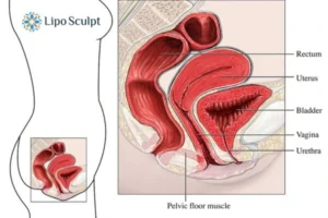 Treatment For A Leaky Bladder 2 How EM Chair treatment Bootle can help Leaky bladder issues. Read more now!