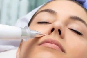 Best Actinic Keratoses Removal 3 Actinic keratoses Bootle solutions - book in today!