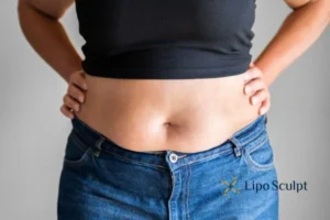 Bidding Farewell to Muffin Tops with Aqualyx Fat Injections 2 Do you wish you could reduce your muffin top Bootle With Aqualy fat dissolving injections you can!